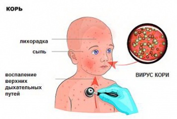 Новости » Криминал и ЧП: Почти три десятка случаев кори зарегистрировано в Симферополе